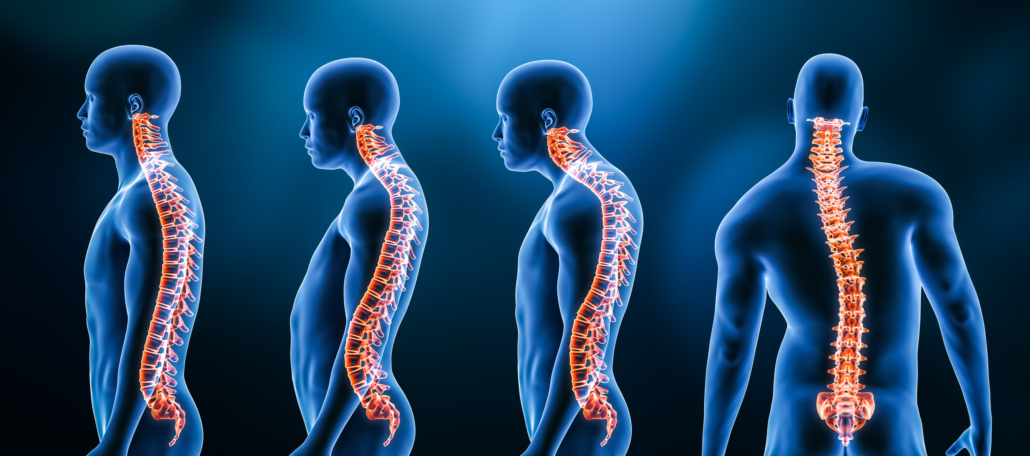 How to perfect your posture: 7 points to consider every day - The Robin  Kiashek Clinics